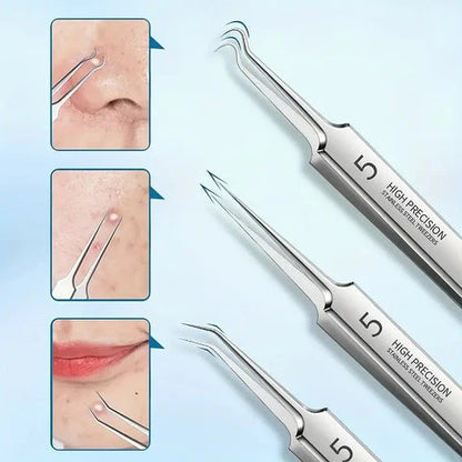 Luxora Blackhead Pliers - Anti Blackhead Kit Set 3 Pcs
