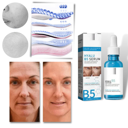 Luxora Rejuvenating Hyalu B5 Hyaluronic Acid Serum 30ml