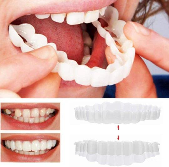 Clip-on smile veneer for broken or stained teeth, reusable cosmetic dental cover with natural white finish, instant smile makeover, comfortable and safe fit.